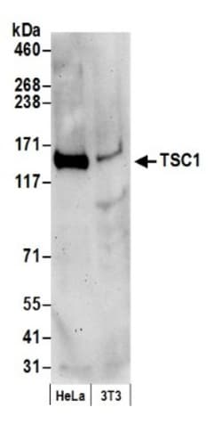 TSC1 Antibody, Novus Biologicals 100 &mu;L | Buy Online | Novus Biologicals | Fisher Scientific